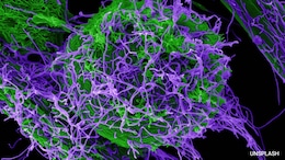 Lab Holding Ebola Virus In Congo's Goma At Risk Amid Fighting: Red Cross