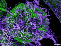 8 Ebola Patients Recover In Uganda, Outbreak "Contained": Minister 8 Ebola Patients Recover In Uganda, Outbreak "Contained": Minister