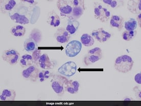 Surge In Deadly Brain-Eating Amoeba Cases In Kerala: Why And How It Spreads