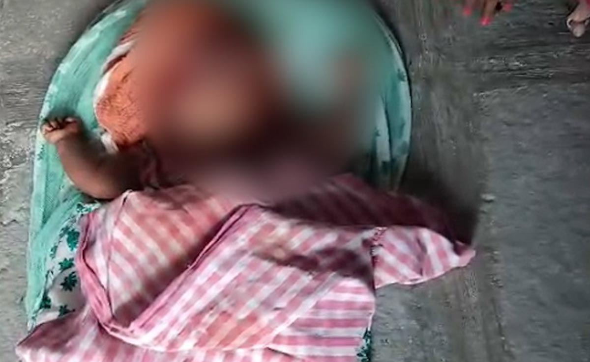 Dog Mauls 5-Month-Old Baby To Death In Telangana Home