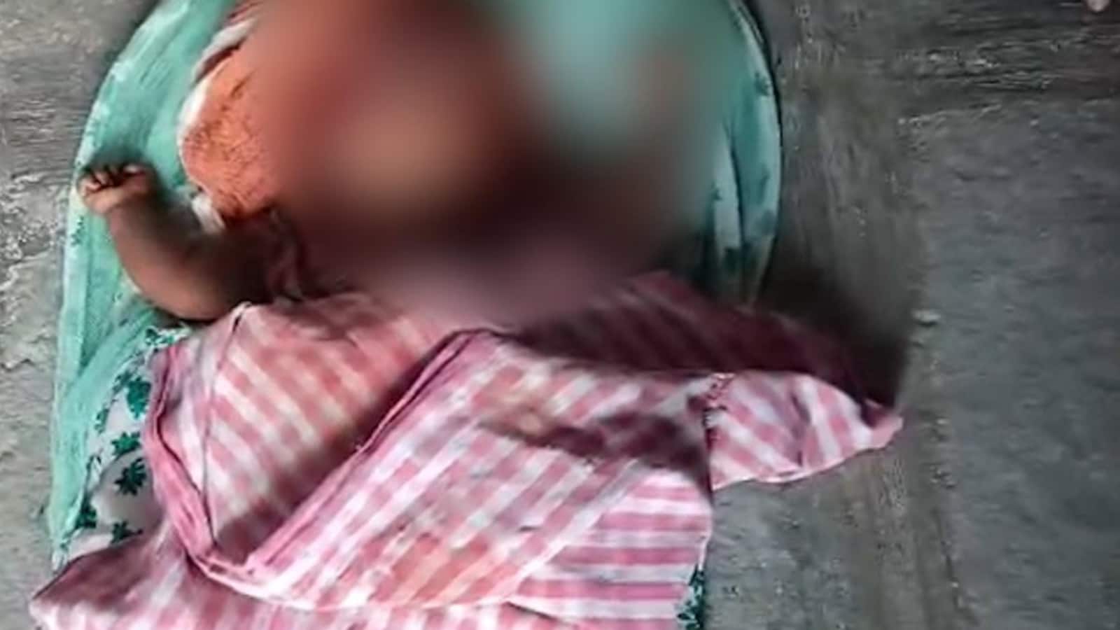 Telangana News: Dog Mauls 5-Month-Old Baby To Death In Telangana Home