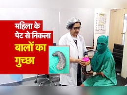 प्रेगनेंसी में महिला खा रही थी बाल, आपरेशन कर पेट से निकाला ढाई किलो बालों का गुच्छा प्रेगनेंसी में महिला खा रही थी बाल, आपरेशन कर पेट से निकाला ढाई किलो बालों का गुच्छा