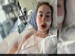 New Zealand Woman "Burned From The Inside" After Severe Reaction From Depression Medication New Zealand Woman "Burned From The Inside" After Severe Reaction From Depression Medication