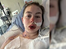 डिप्रेशन की दवा का गंभीर रिएक्शन, जल गए महिला के अंदरूनी अंग, स्किन के बाहर तक दिखे घाव, स्टीवन-जॉनसन सिंड्रोम से हुई पीड़ित