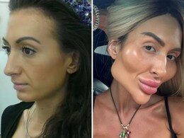 ये हैं दुनिया की सबसे बड़े गालों वाली महिला, ट्रीटमेंट से इतनी बदल गई शक्ल कि खुद भी रह गईं दंग