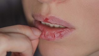 Acharya Balkrishna ने बताया जबरदस्त नुस्खा: सर्दी में होंठ रहेंगे मुलायम, फटने और रूखे पड़ने की झंझट हो जाएगी