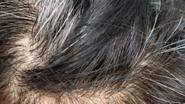 White Hair Remedy: बालों को सफेद होने से रोकते हैं ये Super Foods, डाइट में शामिल करते ही दिखने लगेगा असर