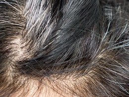 White Hair Remedy: बालों को सफेद होने से रोकते हैं ये Super Foods, डाइट में शामिल करते ही दिखने लगेगा असर White Hair Remedy: बालों को सफेद होने से रोकते हैं ये Super Foods, डाइट में शामिल करते ही दिखने लगेगा असर