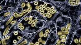 Two-Year-Old Australian Girl Tested Positive For H5N1 Bird Flu: WHO