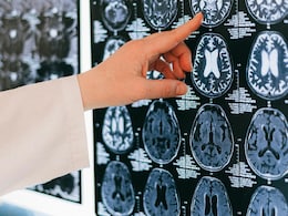 Scientists On Alert As Illness With Rapid Dementia Symptoms Emerges Scientists On Alert As Illness With Rapid Dementia Symptoms Emerges