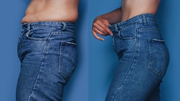 Common Causes Of Belly Fat: How To Quickly Lose Fat From Belly