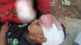 Train Passed Over Kid's Head: रेलवे ट्रैक पर बैठा था मासूम, सिर के ऊपर से गुजर गई पूरी ट्रेन, बाल-बाल बचा बच्चा
