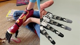 US Boy, Born With One Hand, Becomes Youngest To Receive Bionic Hero Arm At Five