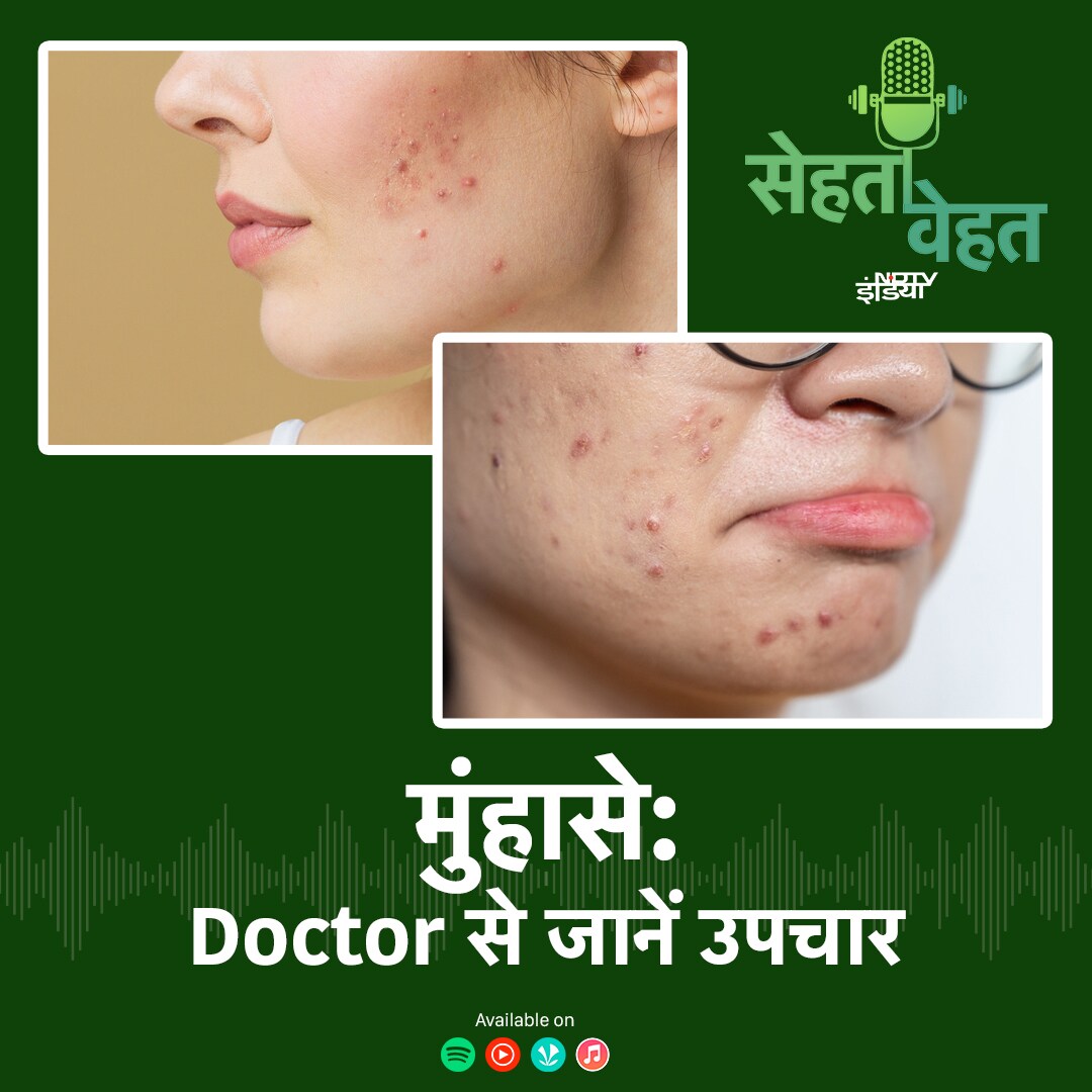 टीनएज में क्यों हो जाते हैं मुंहासे या एक्ने: Doctor से जानें उपचार episode artwork