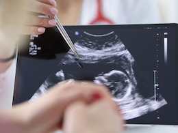 Preventing Haemorrhoids During Pregnancy: Measures And Tips For Expectant Mothers Preventing Haemorrhoids During Pregnancy: Measures And Tips For Expectant Mothers