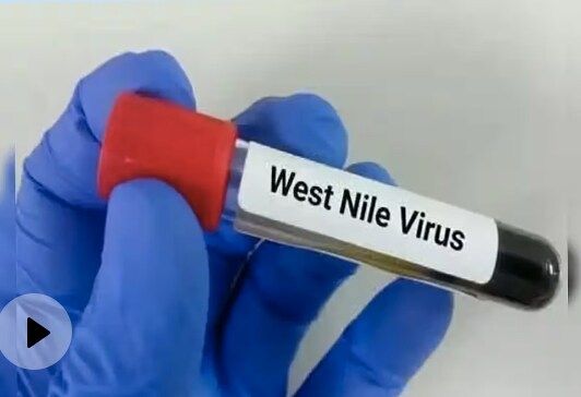 Kerala West Nile Virus: What Is West Nile Fever, Know Its Symptoms And Prevention Measures. NDTV India