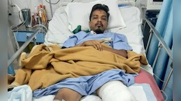 फटका गँगमुळे गमावले पाय, ठाण्याजवळ लोकलमधून पडला तरुण