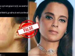 Fact Check: गाल पर थप्पड़ के निशान वाली ये फोटो कंगना रनौत की नहीं है Fact Check: गाल पर थप्पड़ के निशान वाली ये फोटो कंगना रनौत की नहीं है