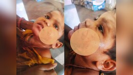 Gwalior: खूंखार सियार ने 3 बच्चों सहित एक महिला पर किया हमला, नोंचे मुंह; हालत गंभीर