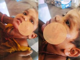 Gwalior: खूंखार सियार ने 3 बच्चों सहित एक महिला पर किया हमला, नोंचे मुंह; हालत गंभीर