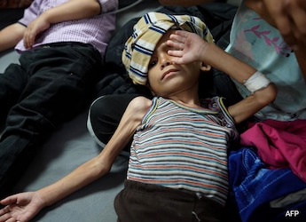 45% Of Vellore's Urban Slum Children Stunted By Age 2, Finds Lancet Study