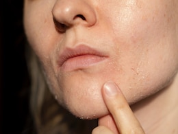 डर्मेटोलॉजिस्ट ने बताया इन 5 ब्यूटी टूल्स का कभी नहीं करना चाहिए इस्तेमाल, हो सकती है त्वचा डैमेज