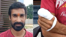 जानलेवा अंधविश्वास! बीजेपी की जीत की रखी मन्नत, पूरी होने पर युवक ने उंगली काटकर देवी मां को चढ़ाया