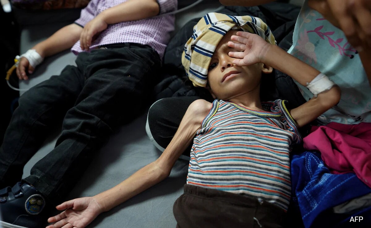 Israel-Palestine: Malnutrition Hits Children Of Gaza As Mothers Search ...