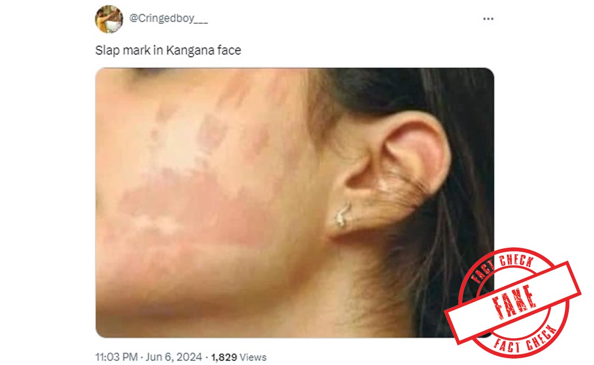 Old Photo From Anti-Mosquito Spray Ad Falsely Linked To Kangana Ranaut Slap Row