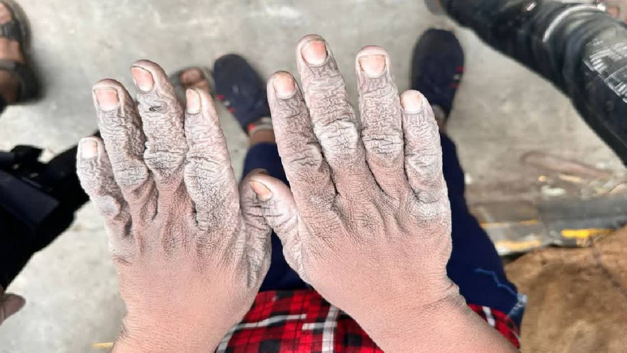 Raisen : शराब फैक्ट्री पर मामला दर्ज, cwc के आदेश पर परिजनों को सौंपे गए बच्चे