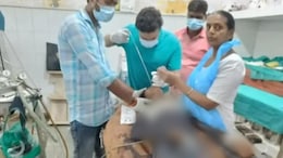 Coin Stuck In Throat Of 12-Year-Old Boy Removed After 7 Years