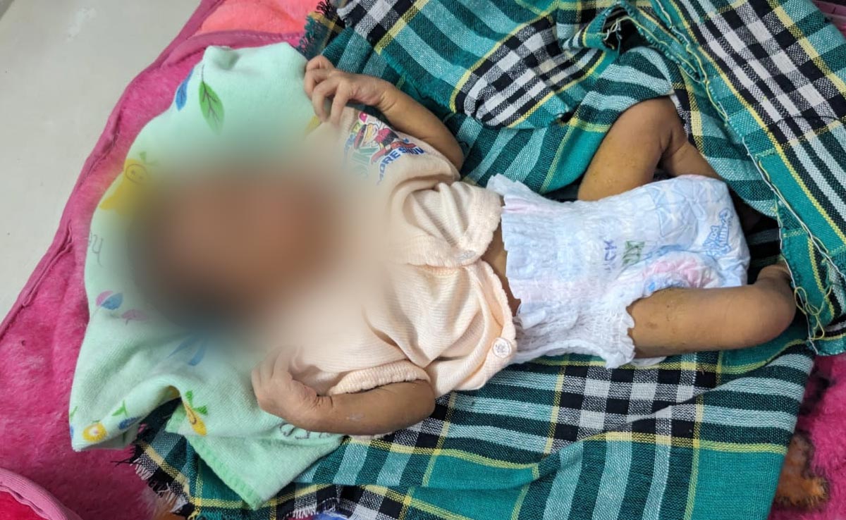 MP में बेटियों को अब भी समझा जा रहा 'बोझ': धूप में बिलखती मिली नवजात बच्ची, पुलिस मां-बाप की तलाश में जुटी