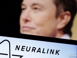 Elon Musk's Neuralink Brain Chip Implant "More Or Less Stable" In 1st Patient Elon Musk's Neuralink Brain Chip Implant "More Or Less Stable" In 1st Patient