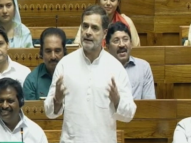 52-Year-Old Man Grows Rare Hair In Throat After Years Of Heavy Smoking