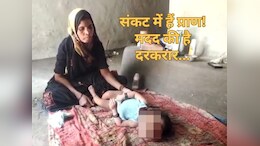 बेटी के इलाज के लिए जमीन जायदाद सब लगा दिया दांव पर, सरकार से टूटी आस, अब कौन...