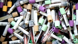 Health Ministry Allows Use Of "Leftover" Organs, Blood, Hair For Research