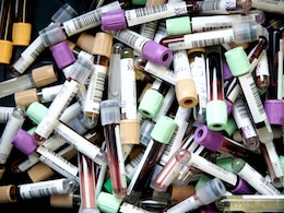 Health Ministry Allows Use Of "Leftover" Organs, Blood, Hair For Research