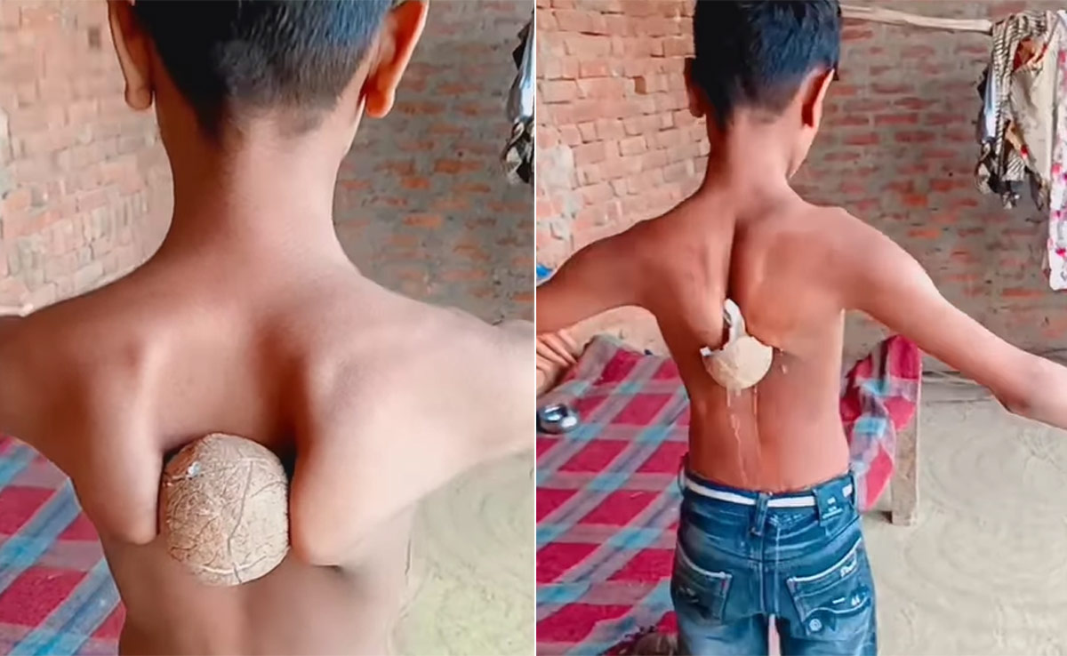 एक ही झटके में पीठ की हड्डियों से तोड़ डाला नारियल, लड़के का कारनामा देख दांतों तले दबा लेंगे उंगली