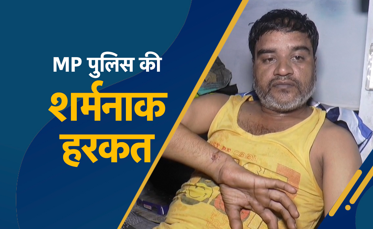 पुलिस की इतनी शर्मनाक हरकत ! ऑटो ड्राइवर को उल्टा लटकाकर पीटा, पेशाब पिलाई और टांग तोड़ दी 