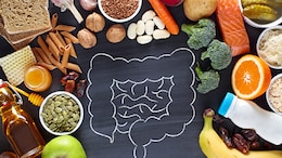 5 Surprising Gut-Healing Foods That Can Be Found In Your Kitchen - Expert Reveals