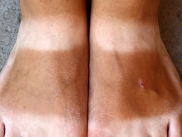 Home Remedies For Tanning: धूप से हो गए हैं पैर काले तो टैनिंग हटाने में काम आएंगें ये घरेलू नुस्खे