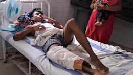 Bihar Health Centre 'Plasters' Man's Fractured Leg With Cardboard