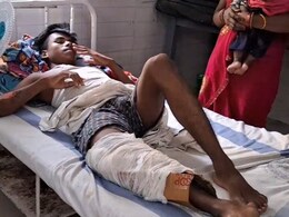 Bihar Health Centre 'Plasters' Man's Fractured Leg With Cardboard