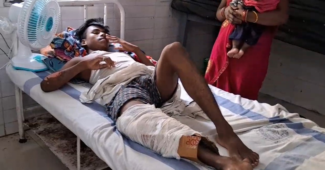 Bihar Health Centre 'Plasters' Man's Fractured Leg With Cardboard