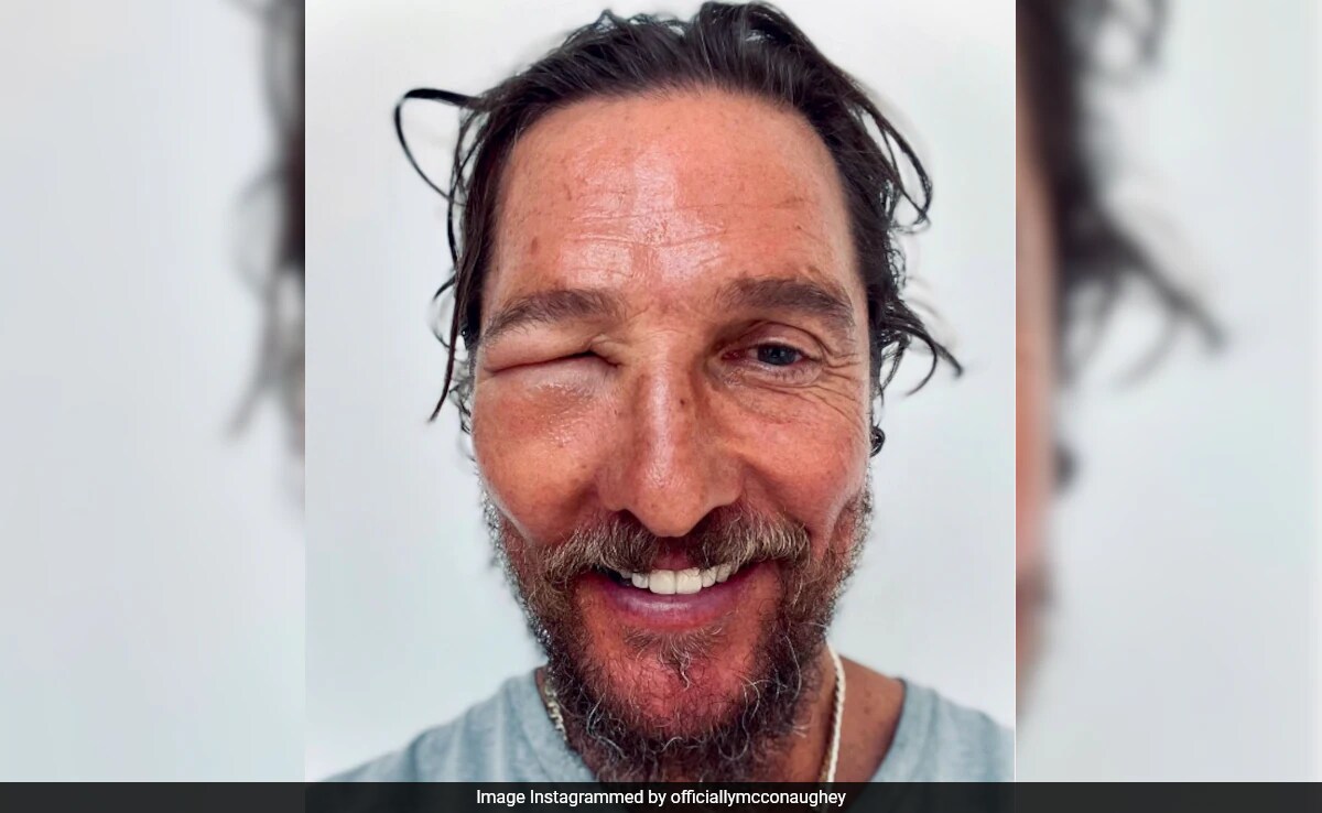 Matthew McConaughey Posted This "Bee Swell" Pic. "I've Been There," Commented Bear Grylls