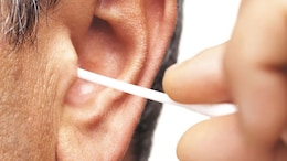 Stop Using Cotton Swabs: Doctor Shares The Right Way To Clean Your Ears Safely