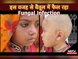 MP News: यहां फैला फंगल इंफेक्शन का कहर, सैकड़ों मासूम हुए इस बीमारी के शिकार MP News: यहां फैला फंगल इंफेक्शन का कहर, सैकड़ों मासूम हुए इस बीमारी के शिकार