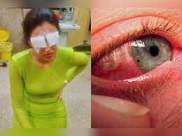 क्या होता है कॉर्निया डैमेज जिसकी वजह से एक्ट्रेस Jasmine Bhasin की जा सकती थी आंखों की रोशनी