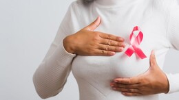 Global Breast Cancer Cases Rise, Indian Spike At 74%: Lancet Study
