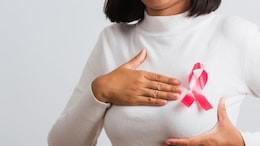 Scientists Develop Blood Test That Predicts The Best Personalised Treatment For Breast Cancer